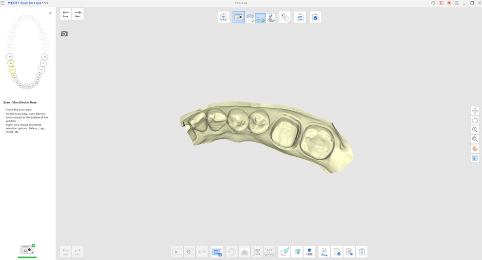 Impression Scan for Occlusion 2.jpg