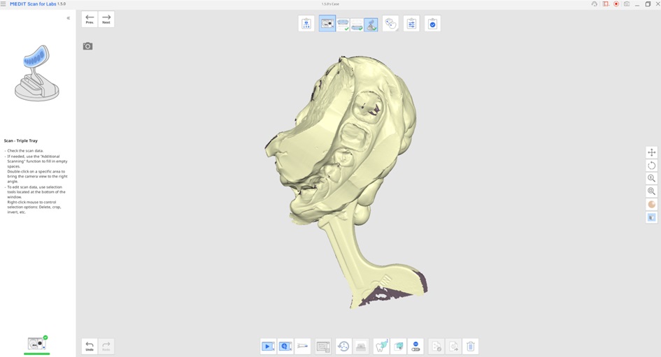 Impression Scan for Occlusion 3.jpg