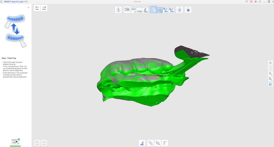 Impression Scan for Occlusion 4.jpg