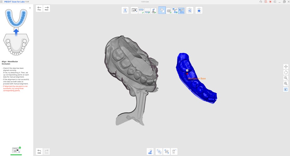 Impression Scan for Occlusion 5.jpg