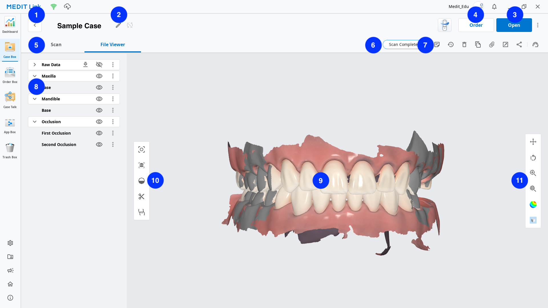 2.5.7_case_detail_overview.png
