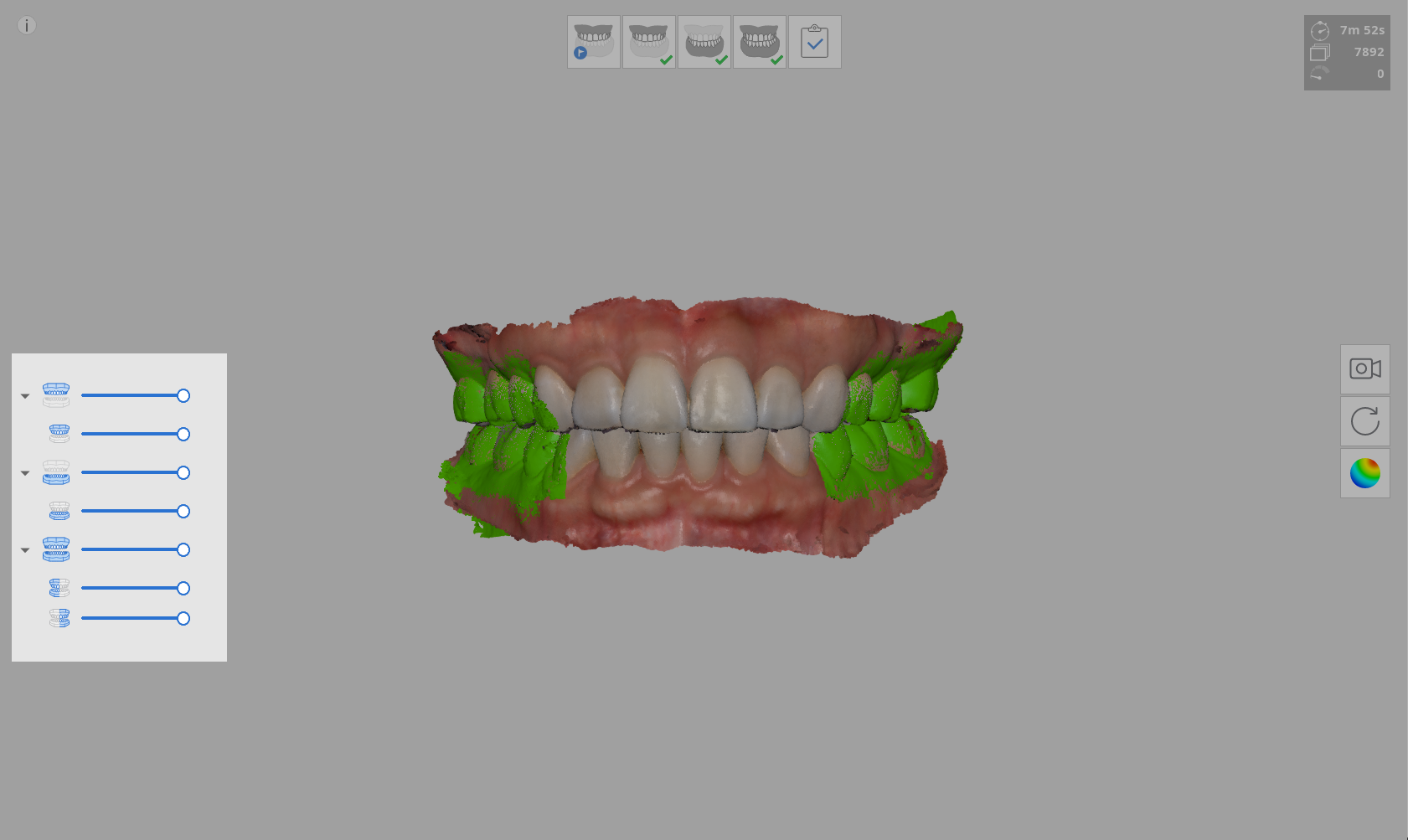 Overview_stage.png