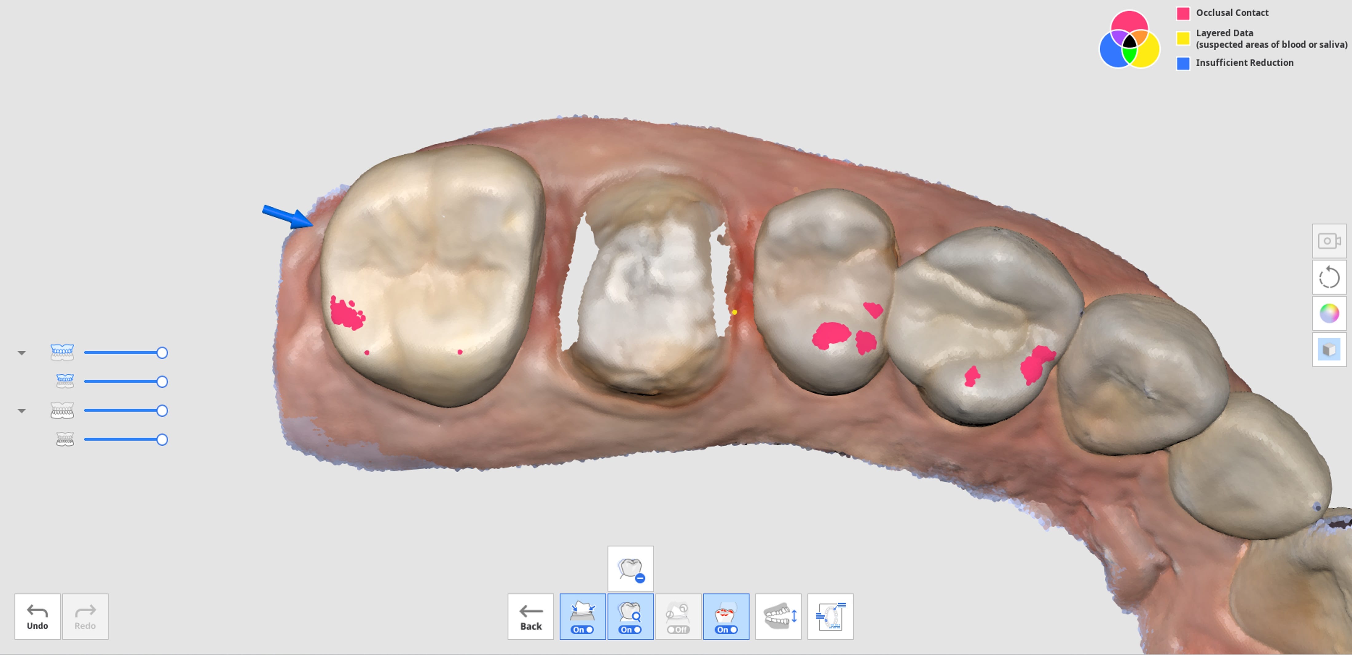 Smart Scan Review Process-8.jpg