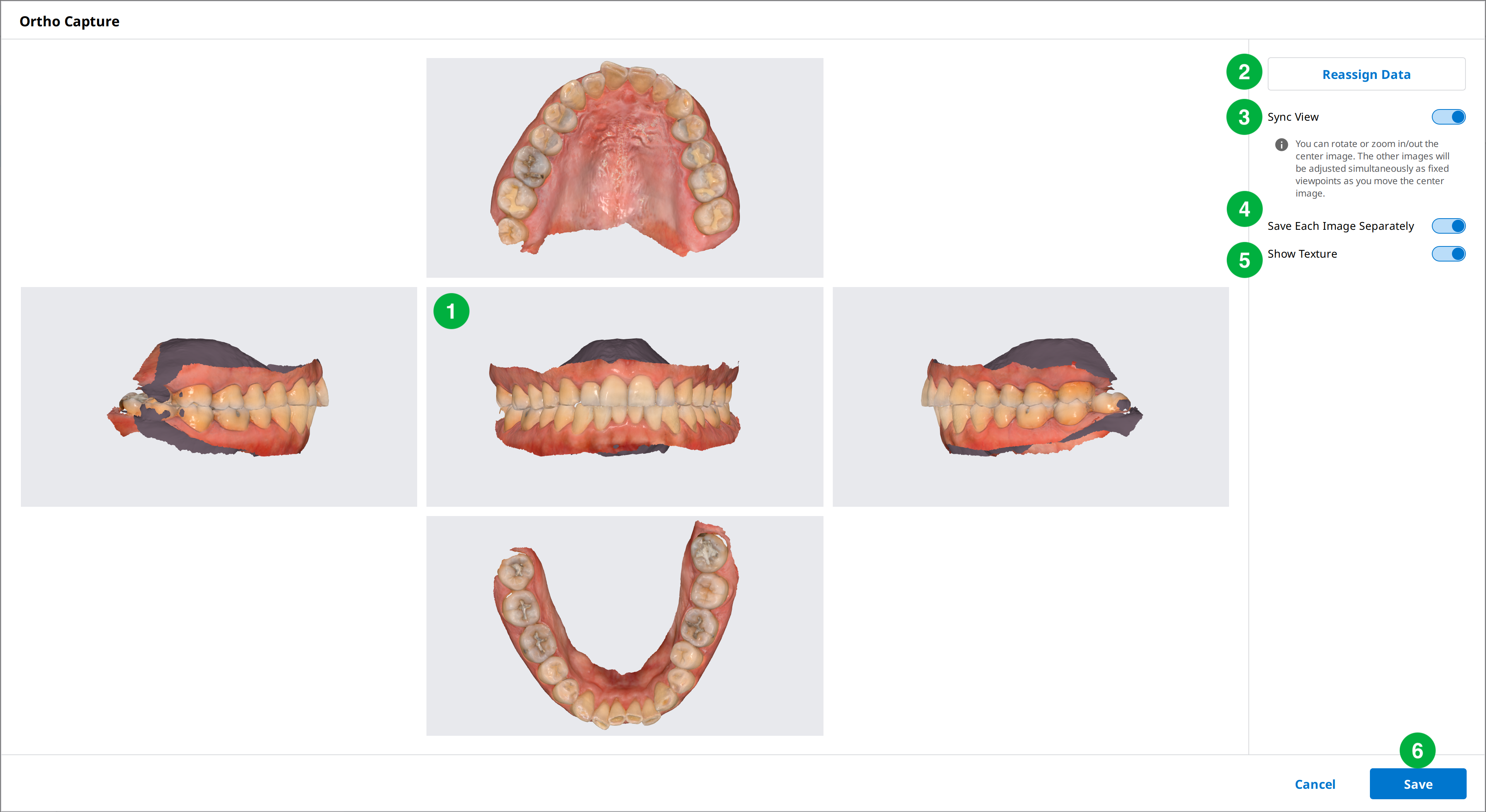 Ortho_capture.png