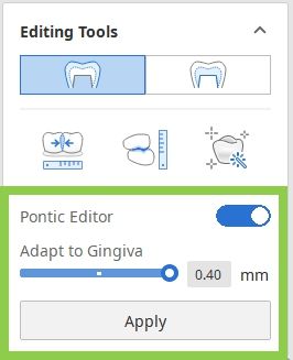 edit_pontic.jpeg