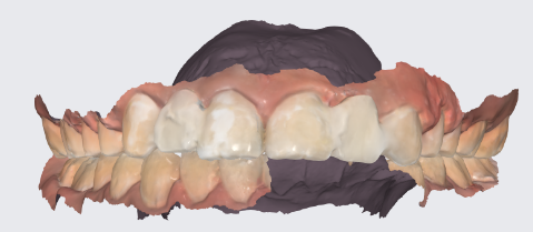 after.png