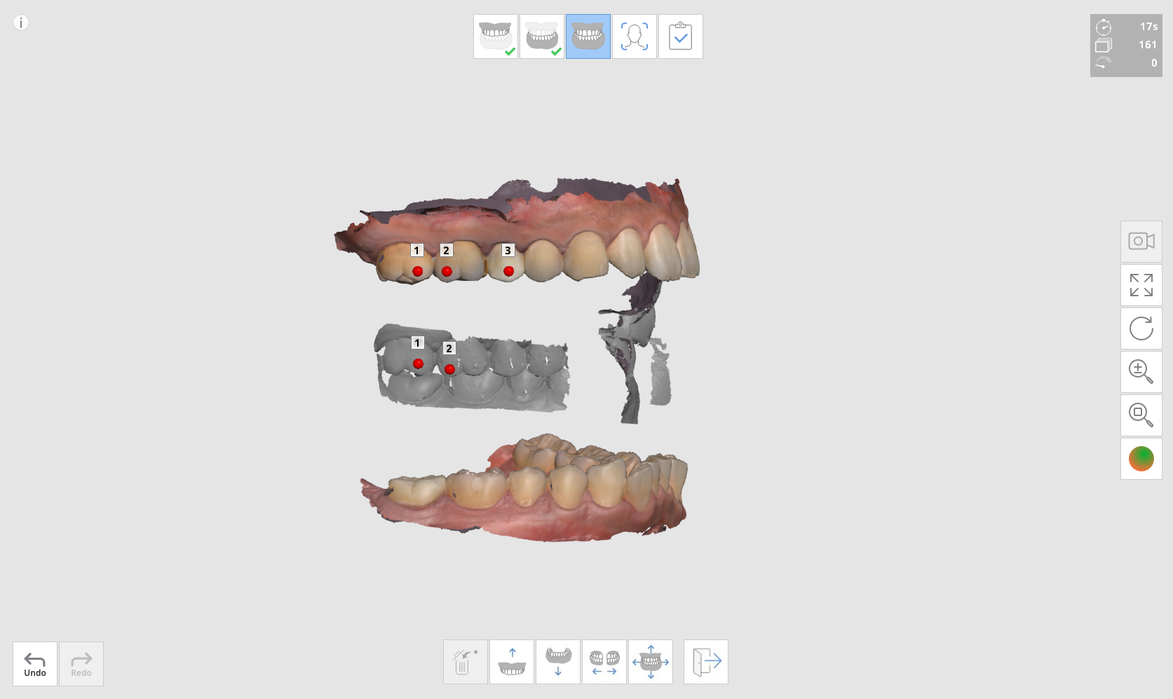 1.5_occlusion.png