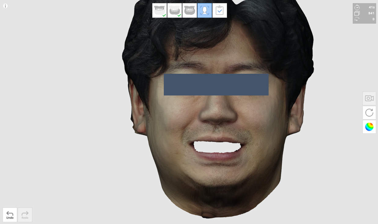 remove_teeth.png