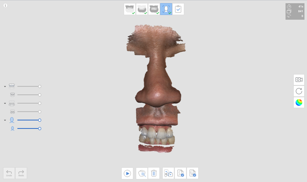 1._step.png