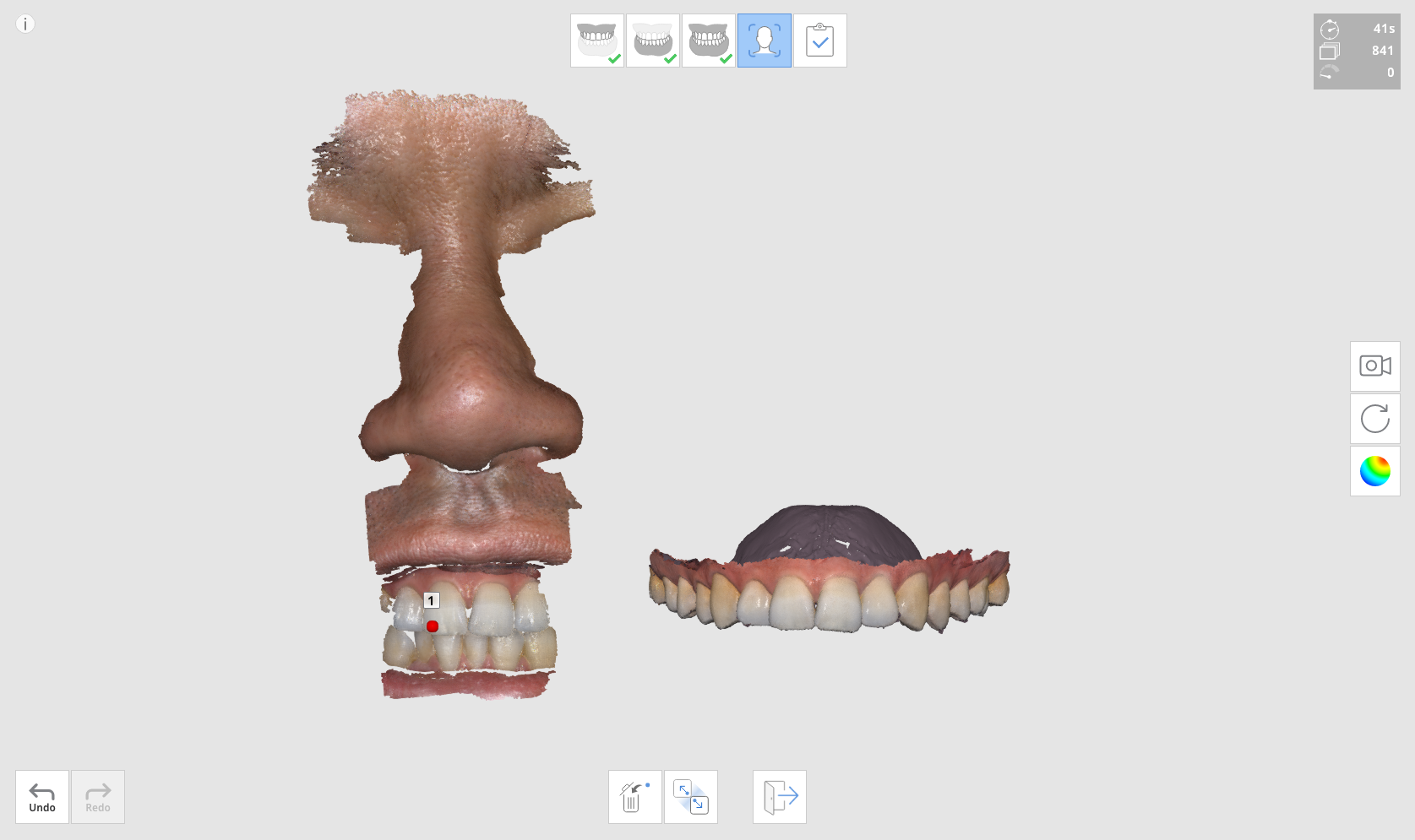 one_point_align.png