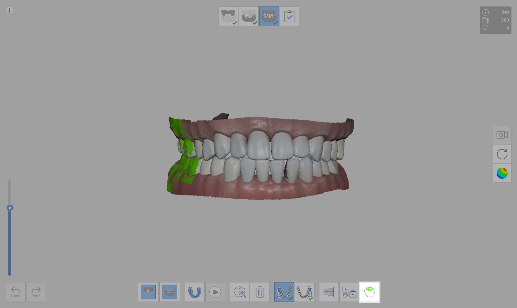occlusion_analysis.jpeg