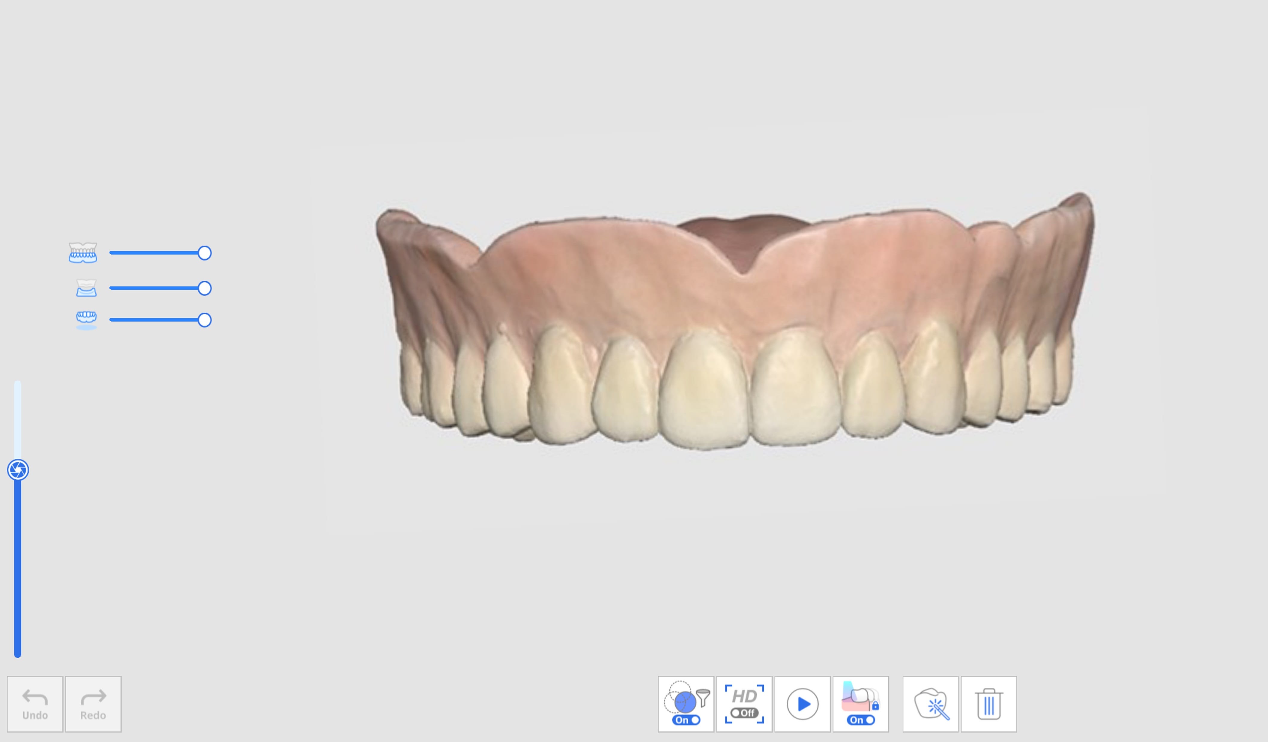 Denture Replica 1.jpg