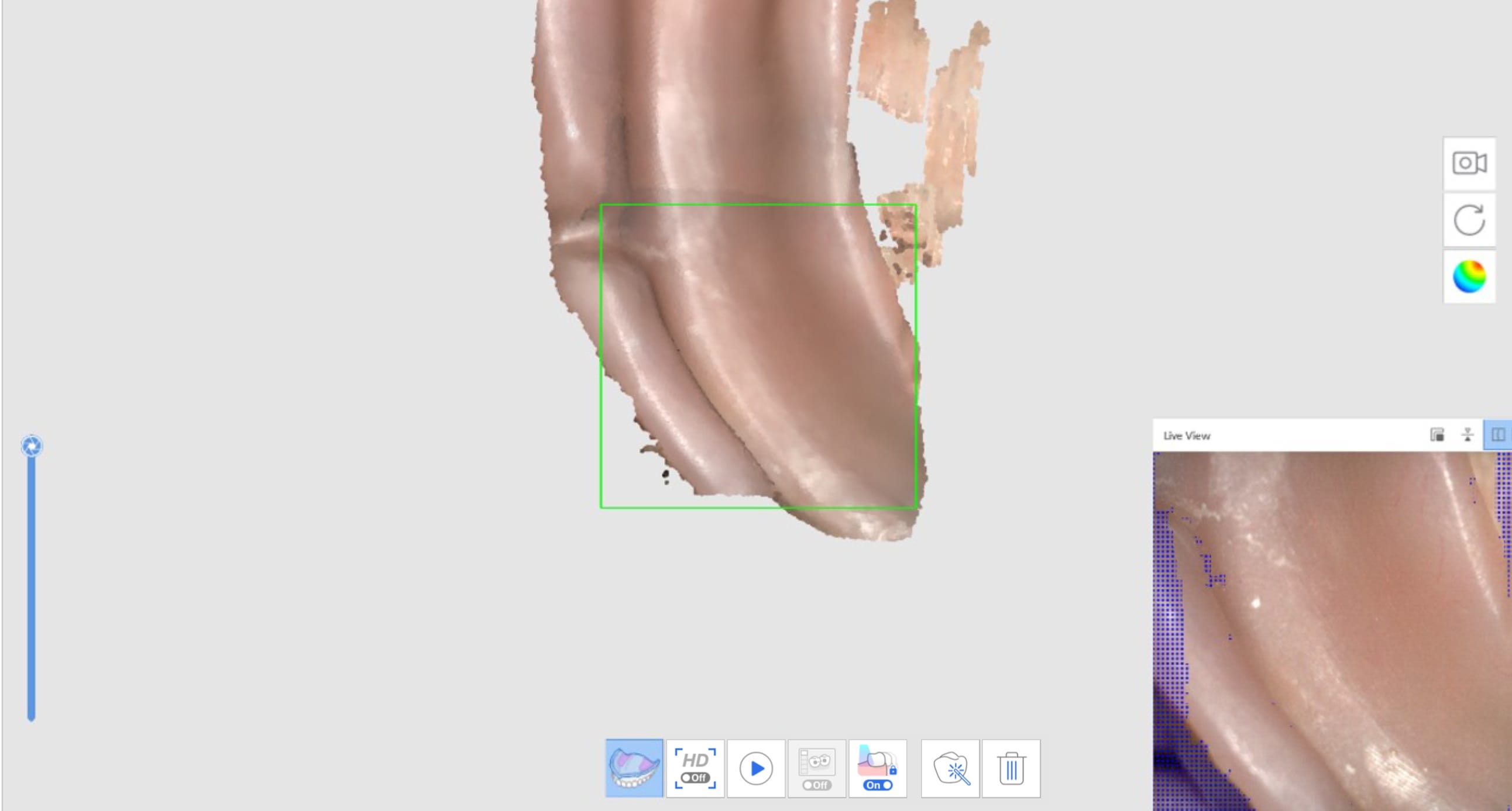 Relined Denture Scan 1 1.jpg