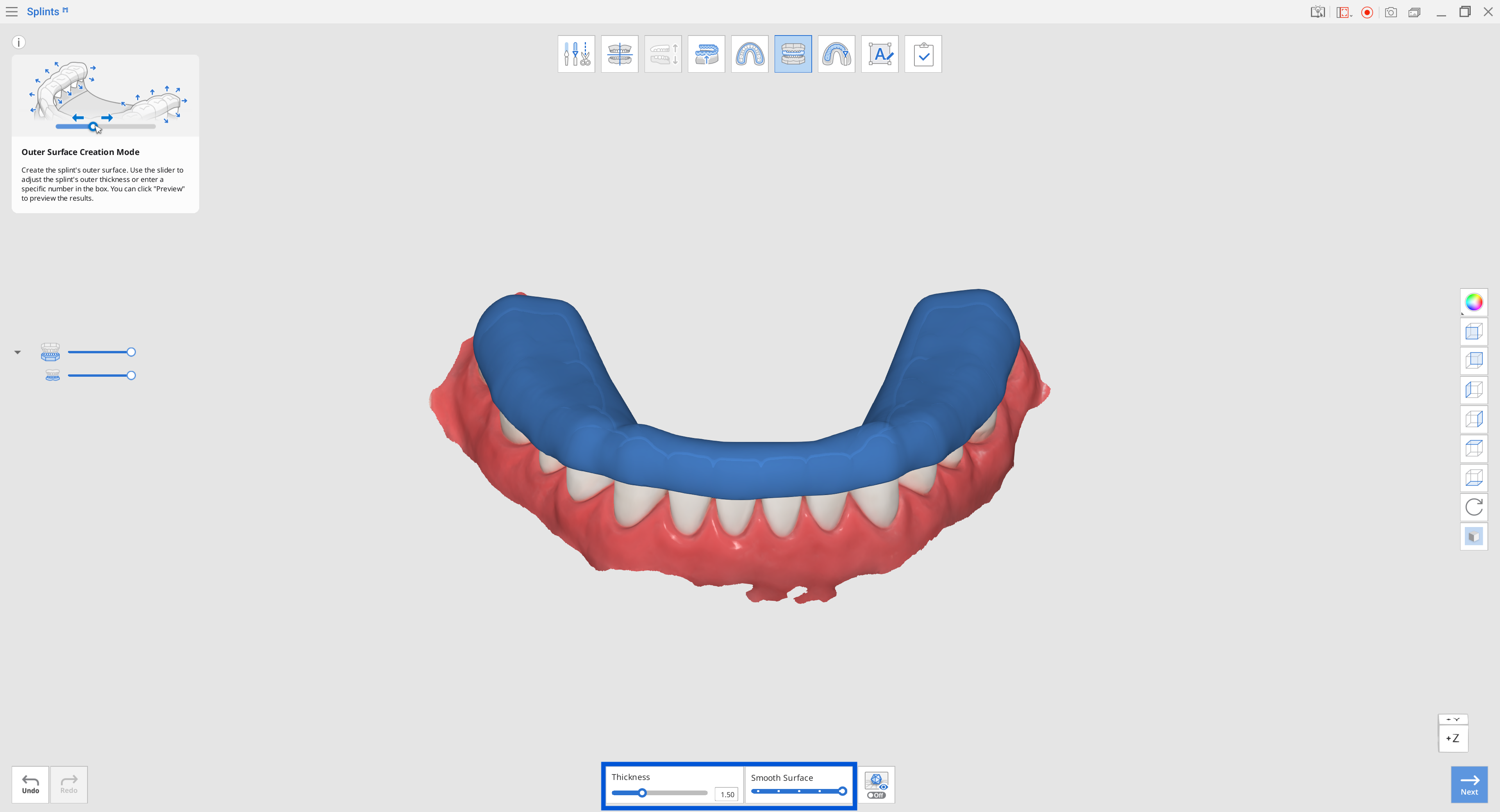 innter_surface.png