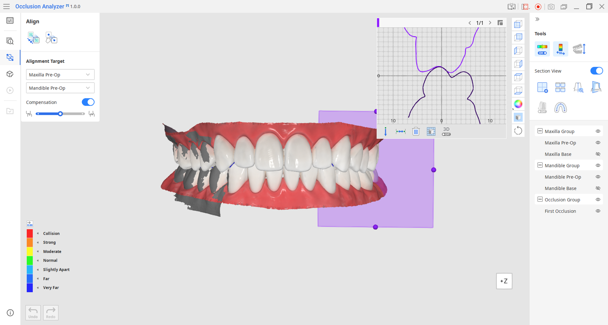 1_align.png