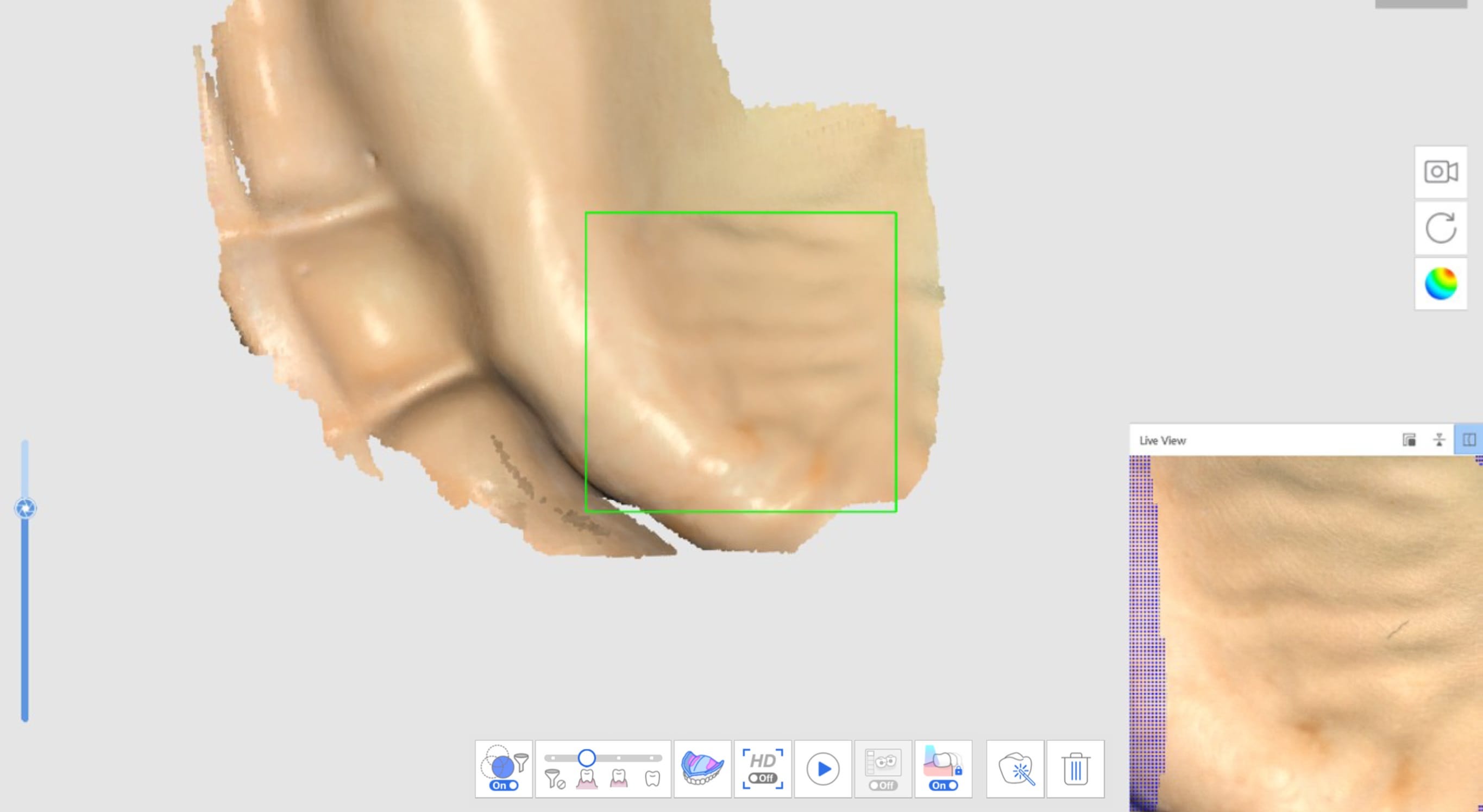 Acquire Edentulous Scan Data 1.jpg