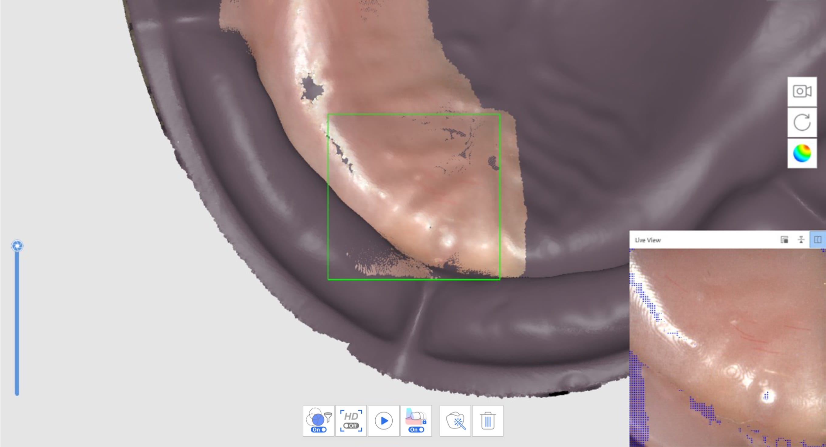 Acquire Edentulous Scan Data 2.jpg