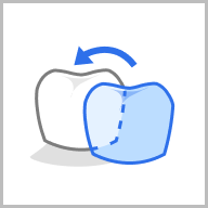 Crown Alignment.png