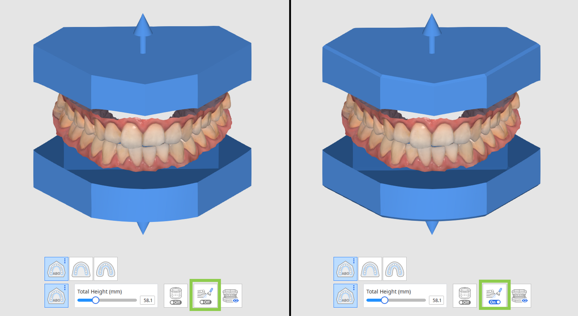 1.3_Use_Bevel.png