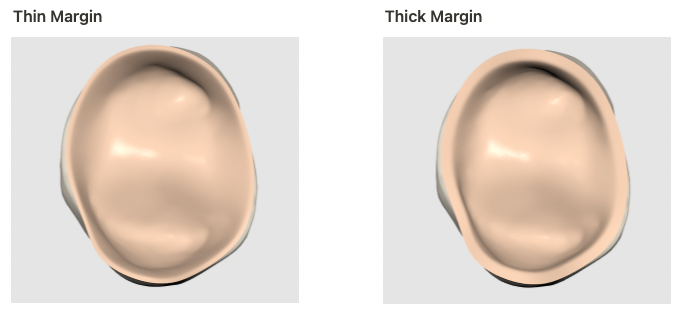 margin_thickness.png