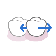 Move along Mesial Distal Direction.png