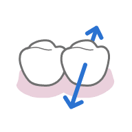 Move along Lingual Buccal Direction.png