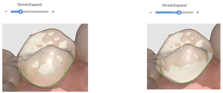margin_adjustment.png