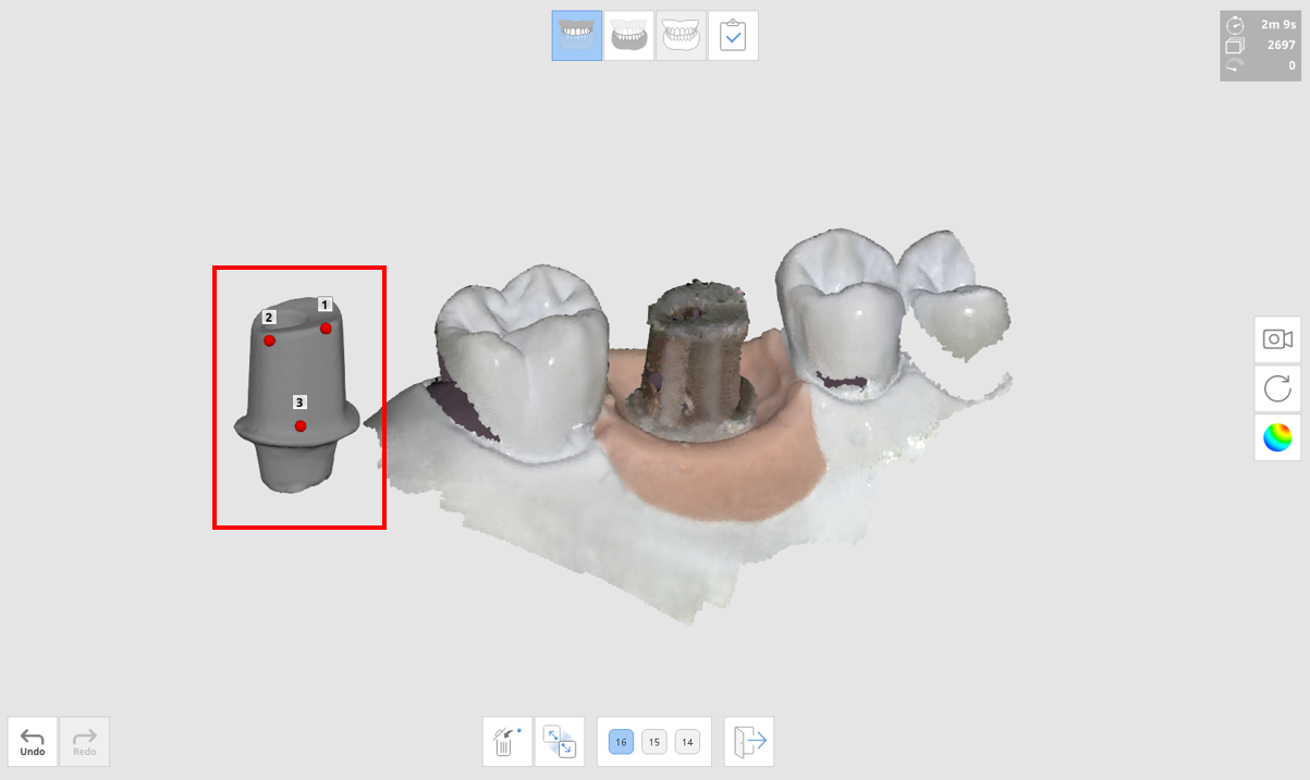 abutment_-_manual_align.png