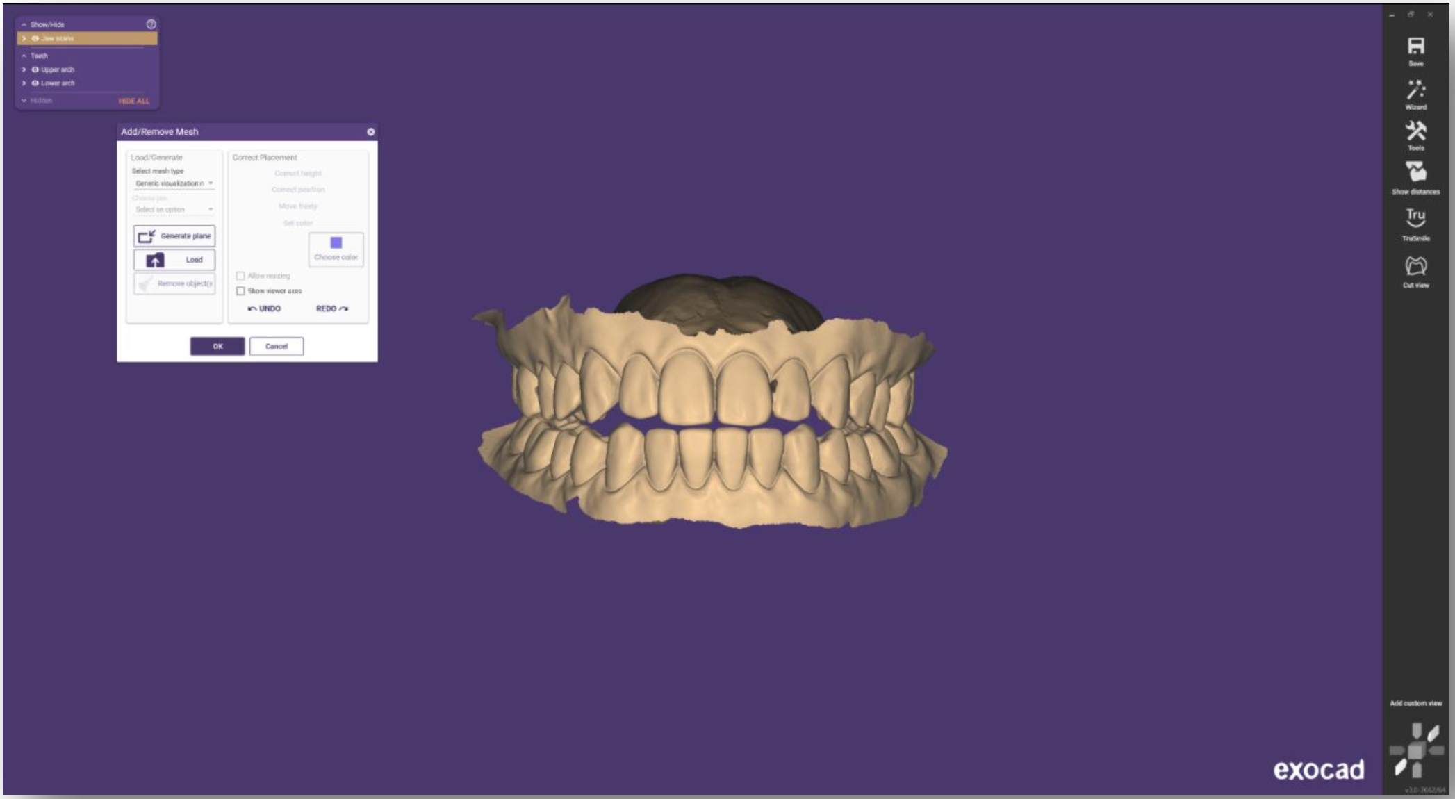 6_multi_occlusion.png