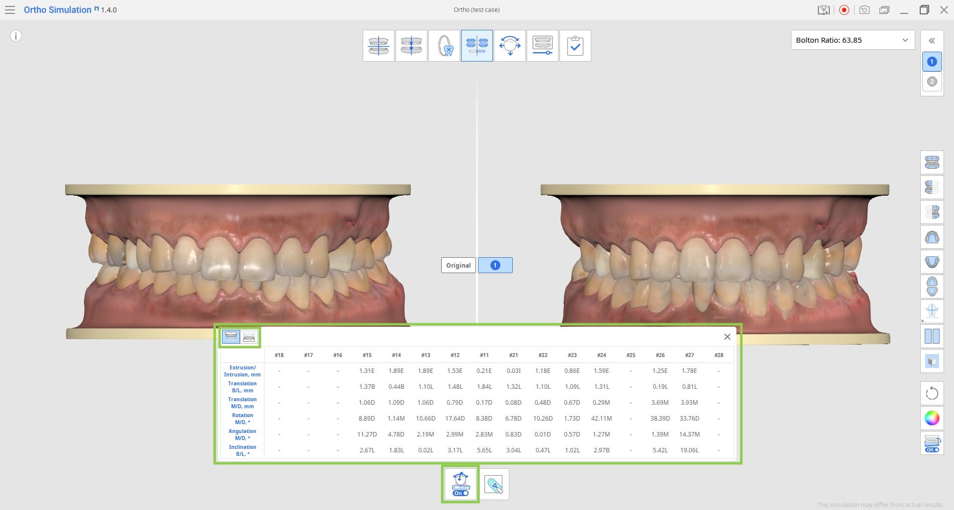 Teeth Movements Data.jpg