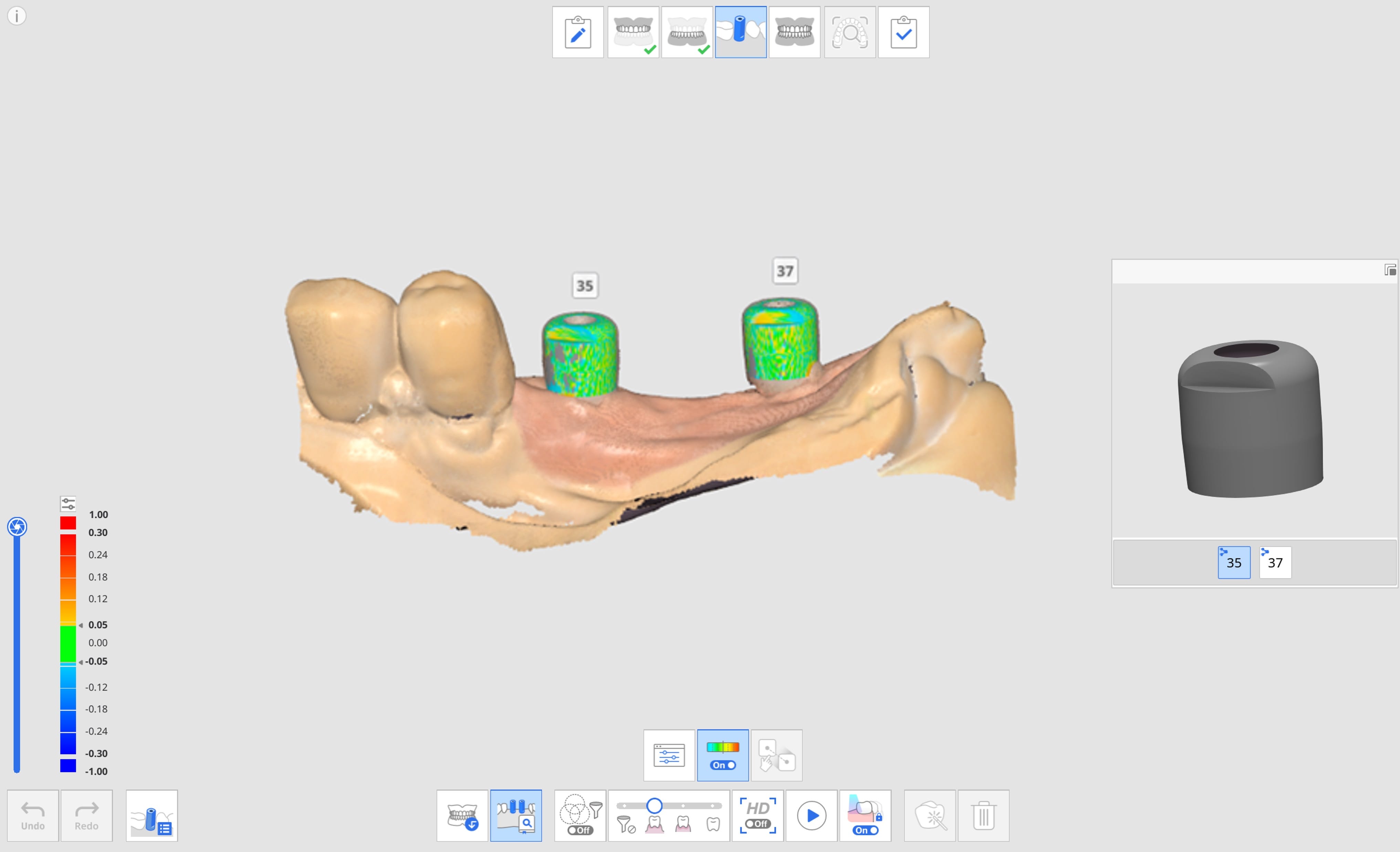 AI Scan Body Matching.jpg