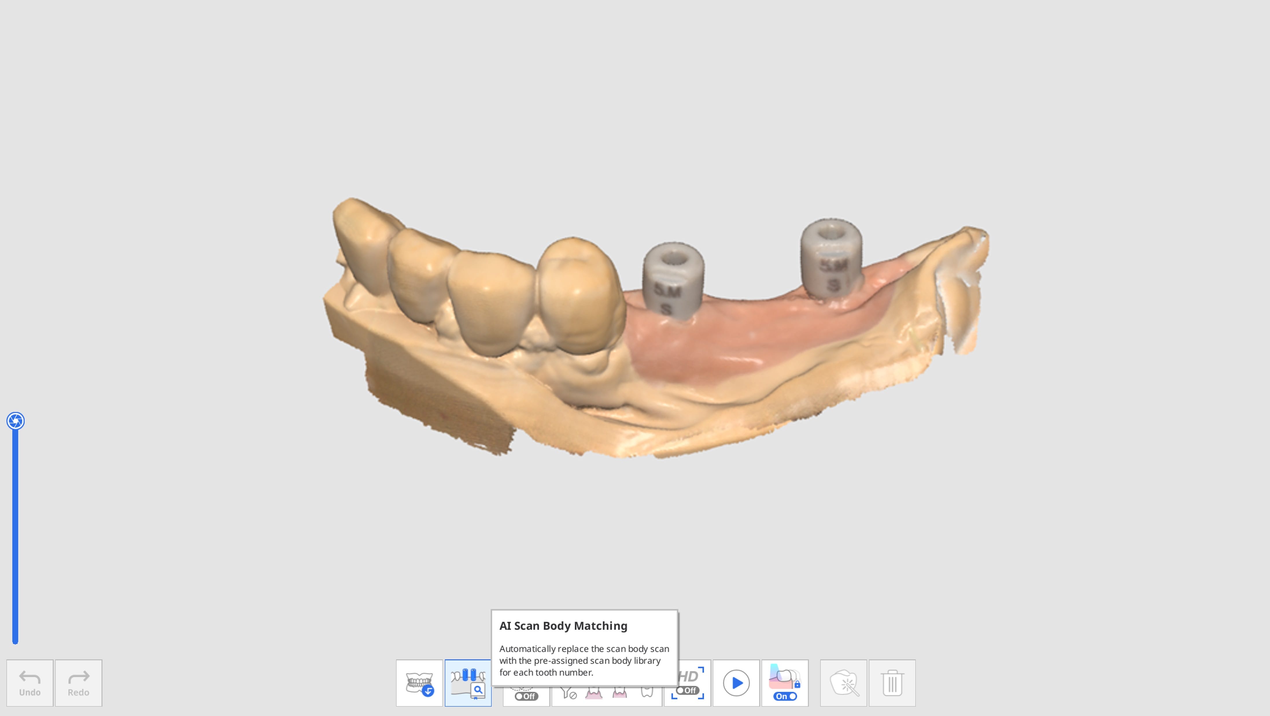 Assign Scan Body Library-2.jpg