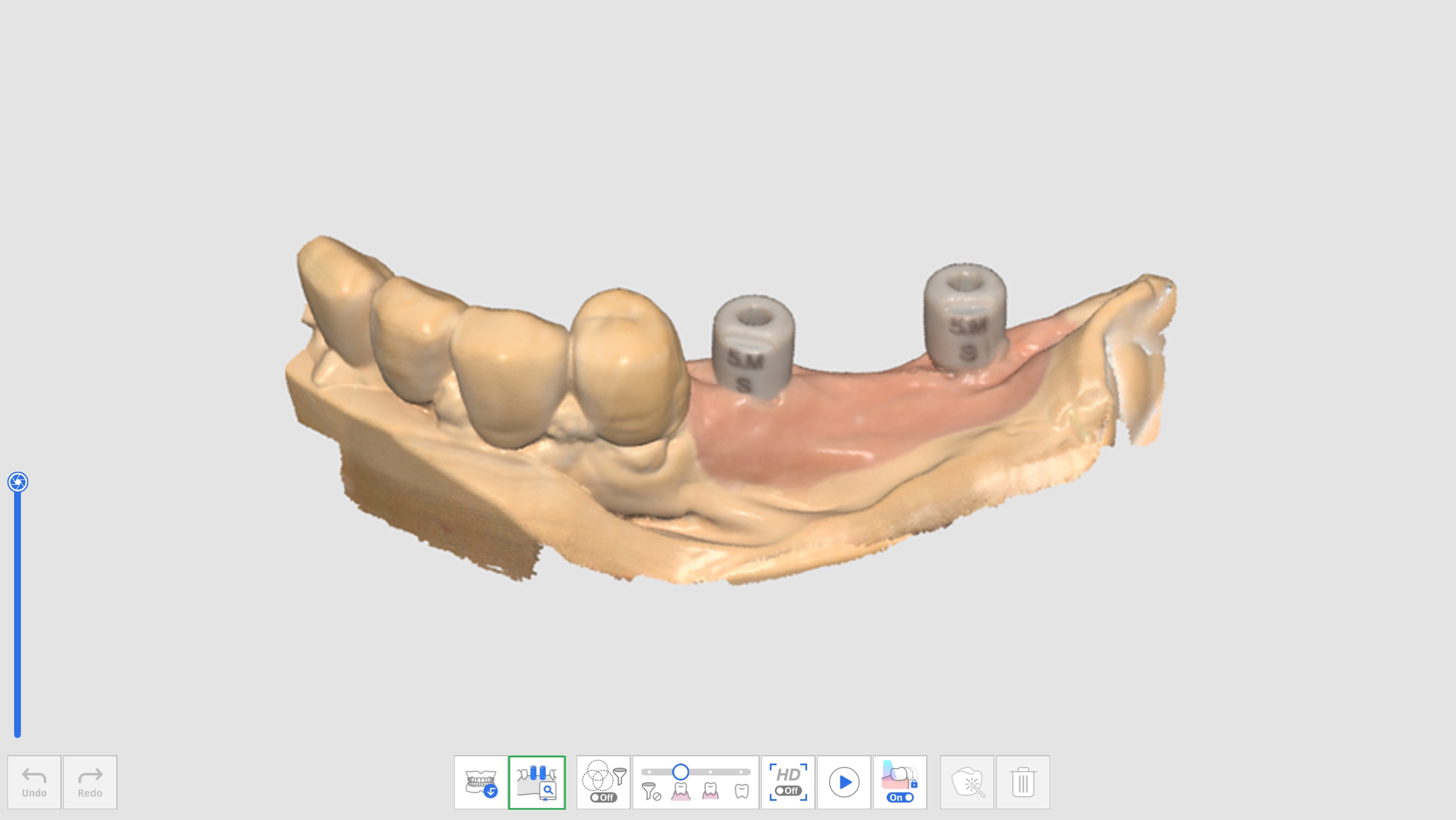 Align Scan Body Library-1.jpg