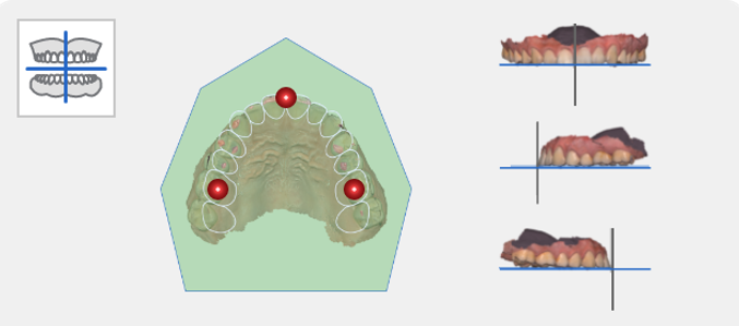 1_4_pts_alignment.png