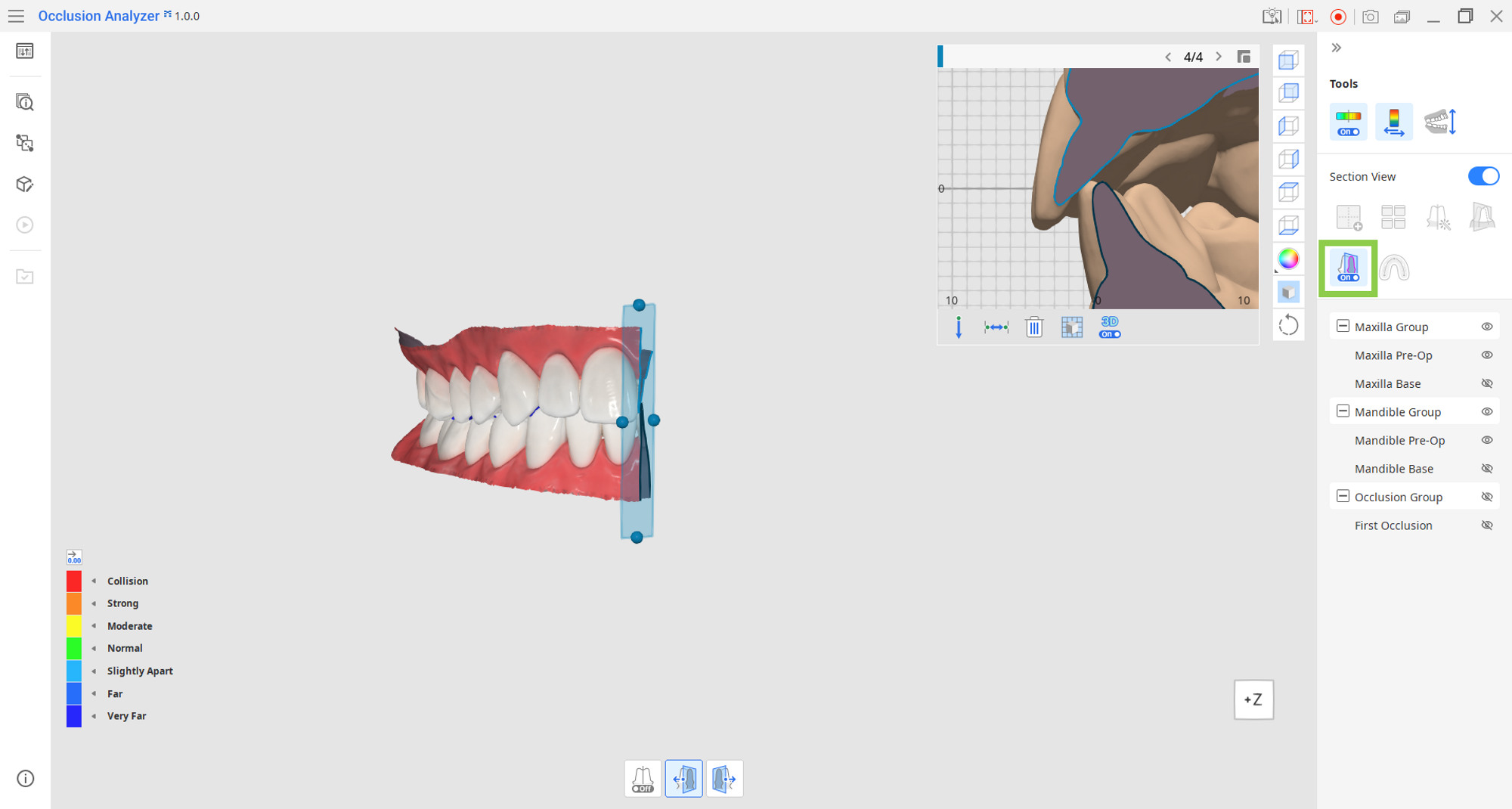 clipping.png