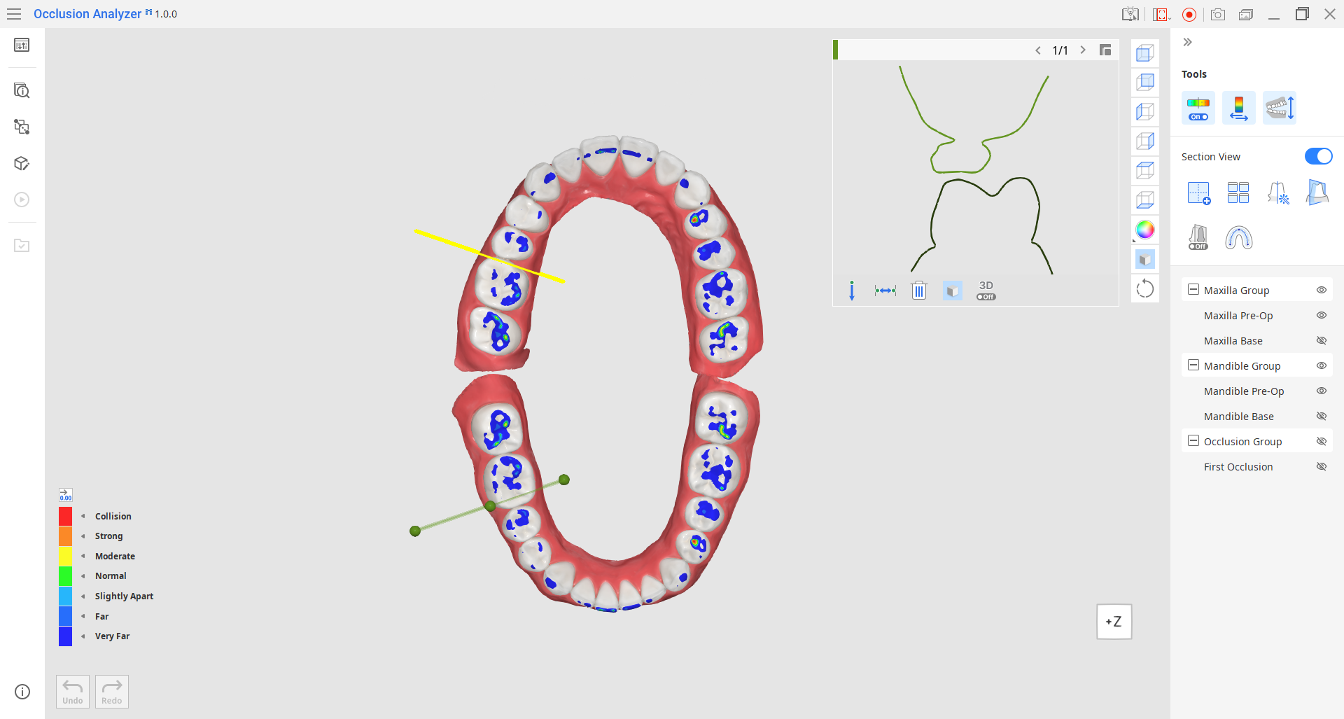 How_to_work_with_seciton_views.png