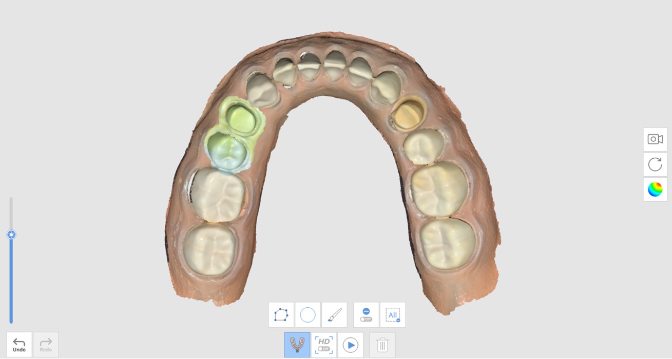 How to Acquire Impression Scan-3.jpg