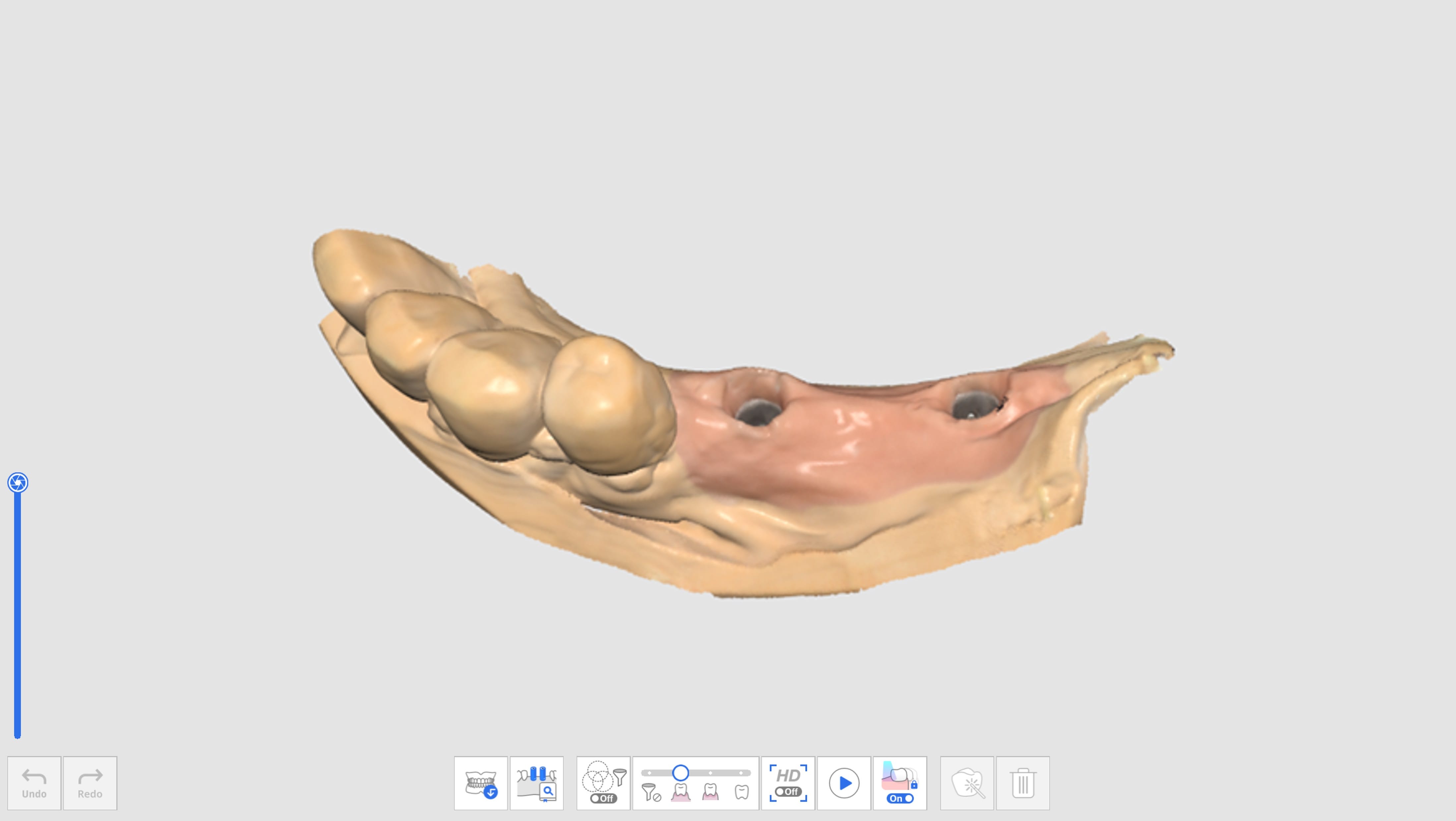 Assign Scan Body Library-1.jpg