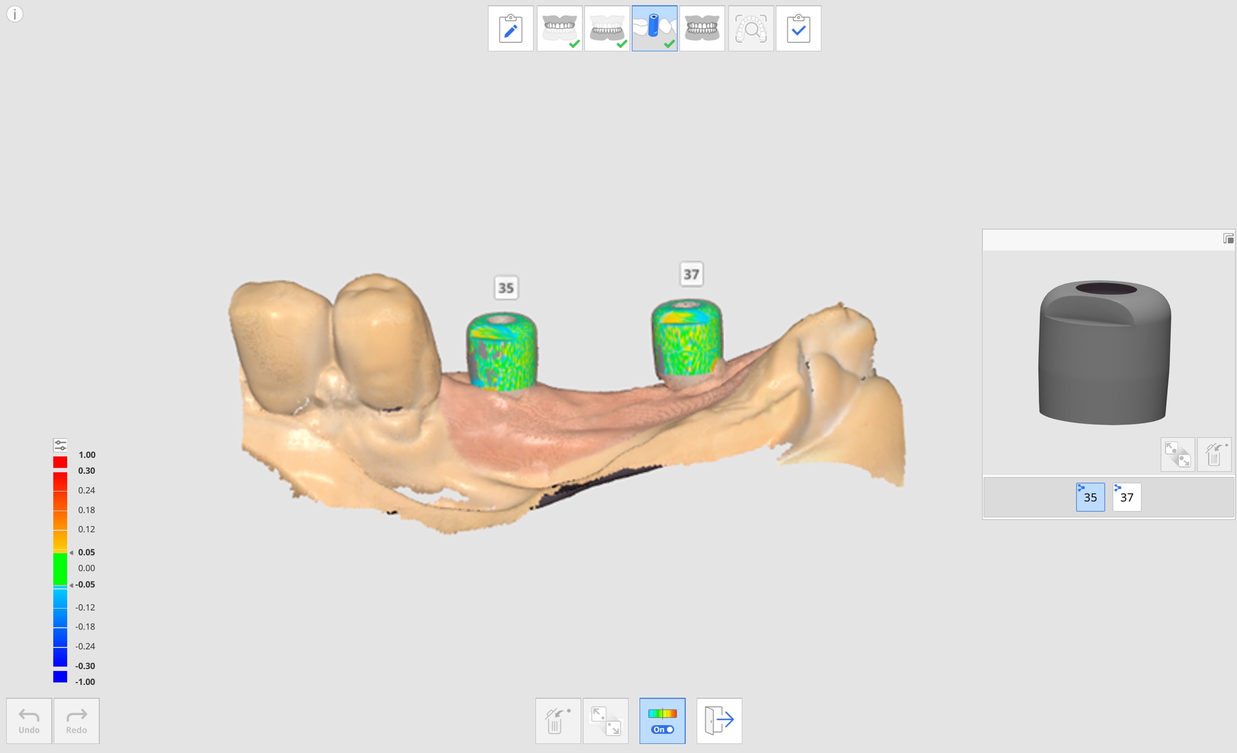 Align Scan Body Library-2.jpg