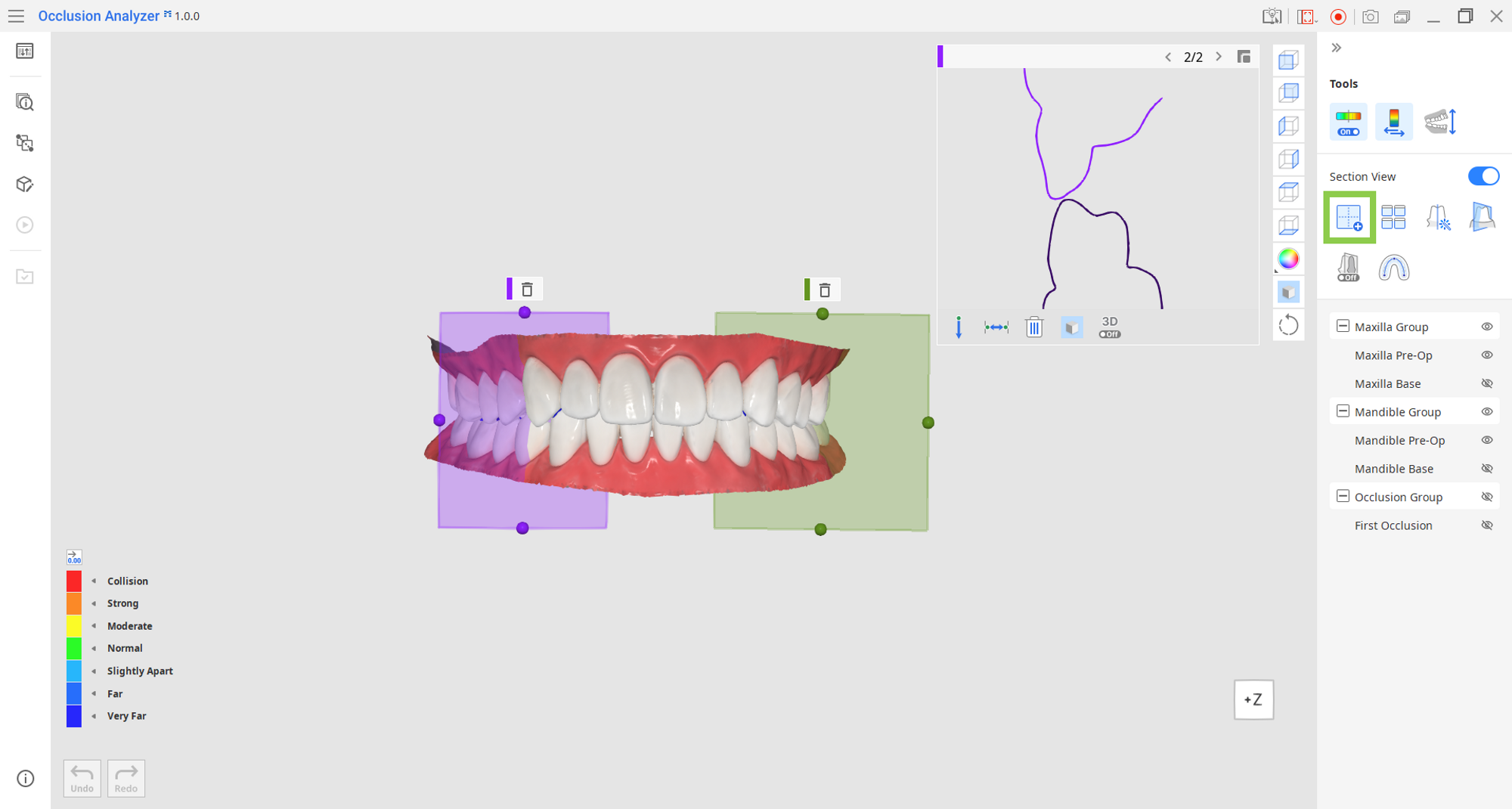 section_1.png
