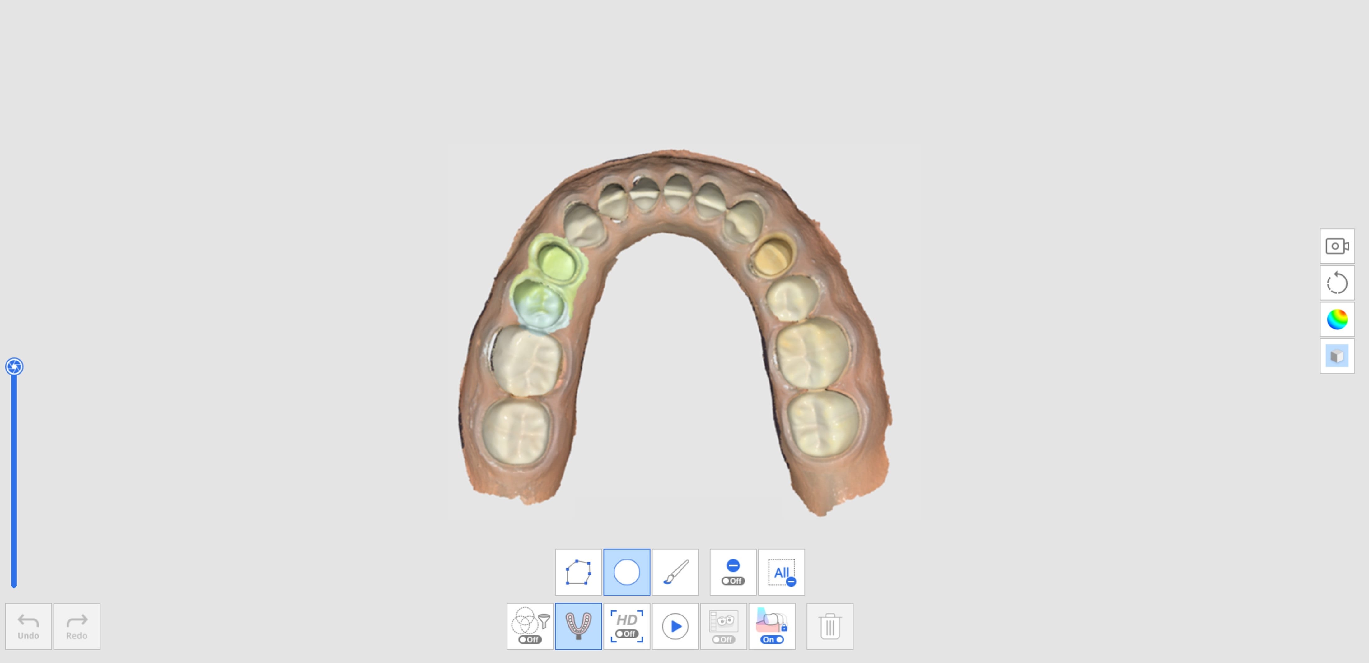 How to Acquire Impression Scan-6.jpg