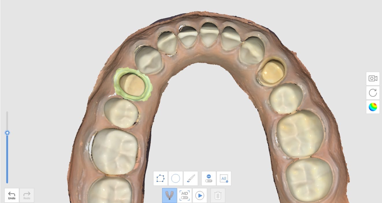 How to Utilize Impression Scan for Margins-3.jpg