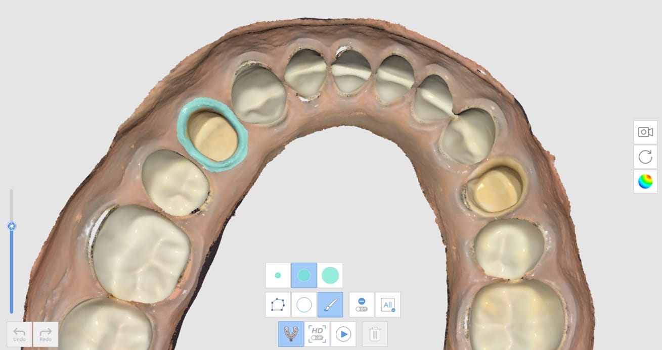 How to Utilize Impression Scan for Margins-2.jpg