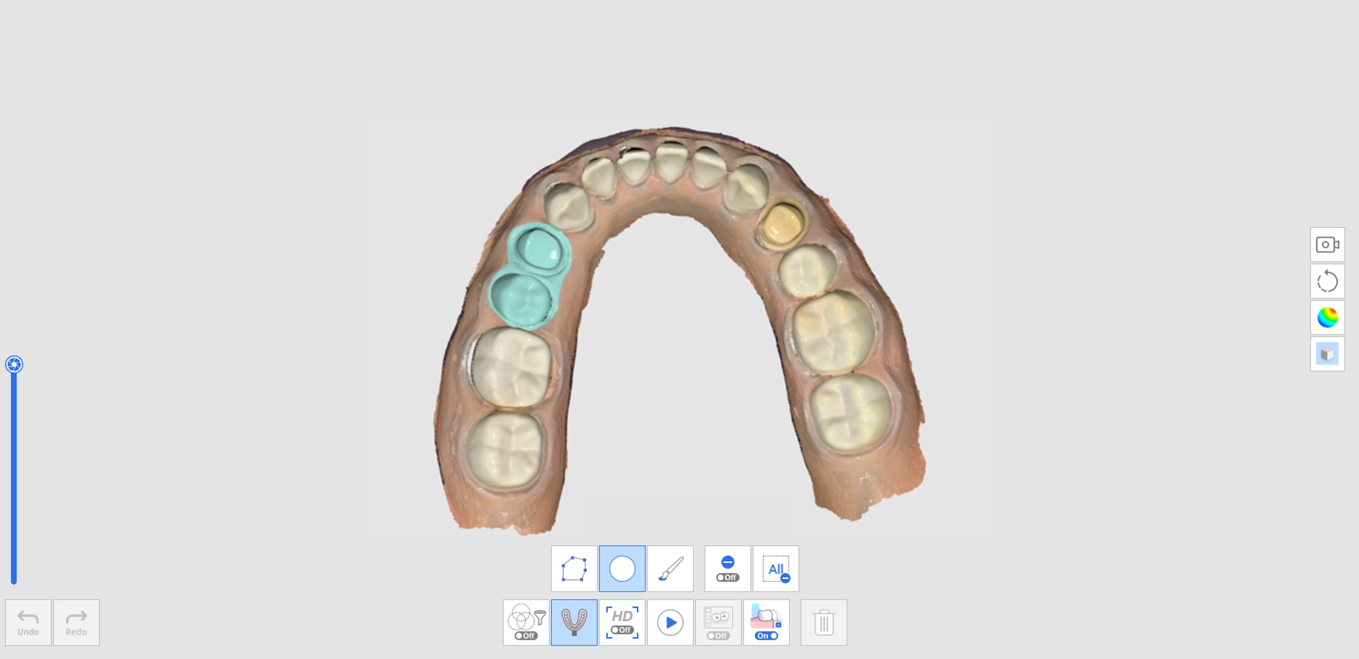 How to Acquire Impression Scan-2.jpg