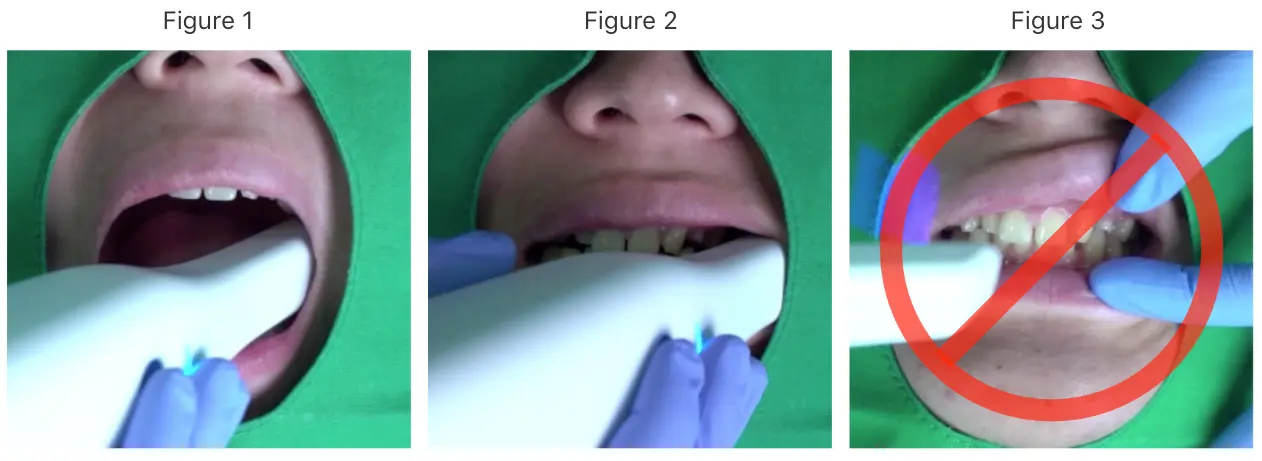 Occlusal scan 1.webp
