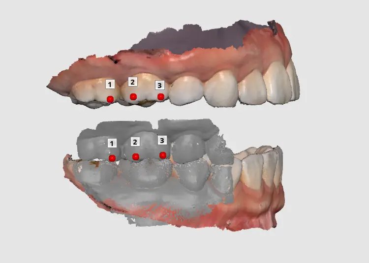 Occlusal scan 3.webp