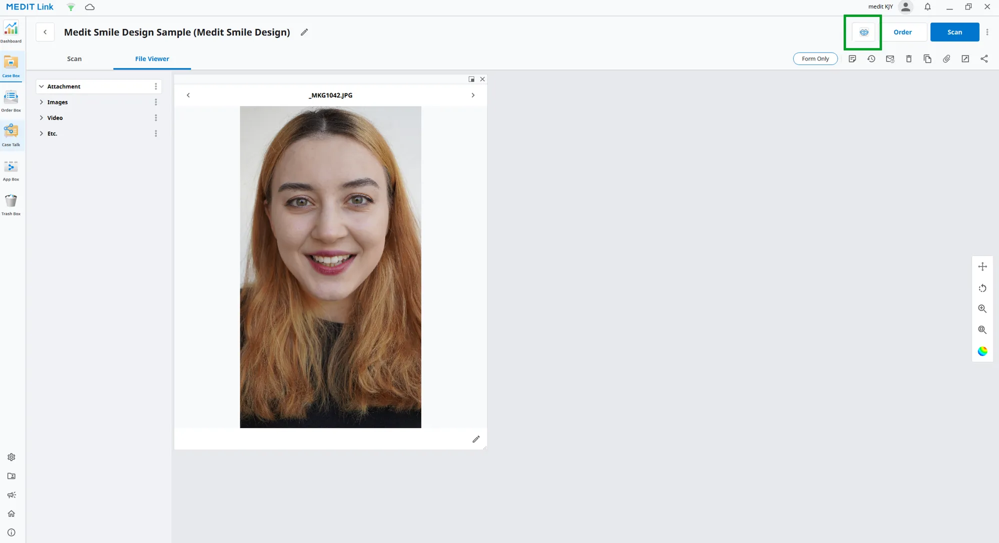 Running Medit Smile Design from Medit Link.webp