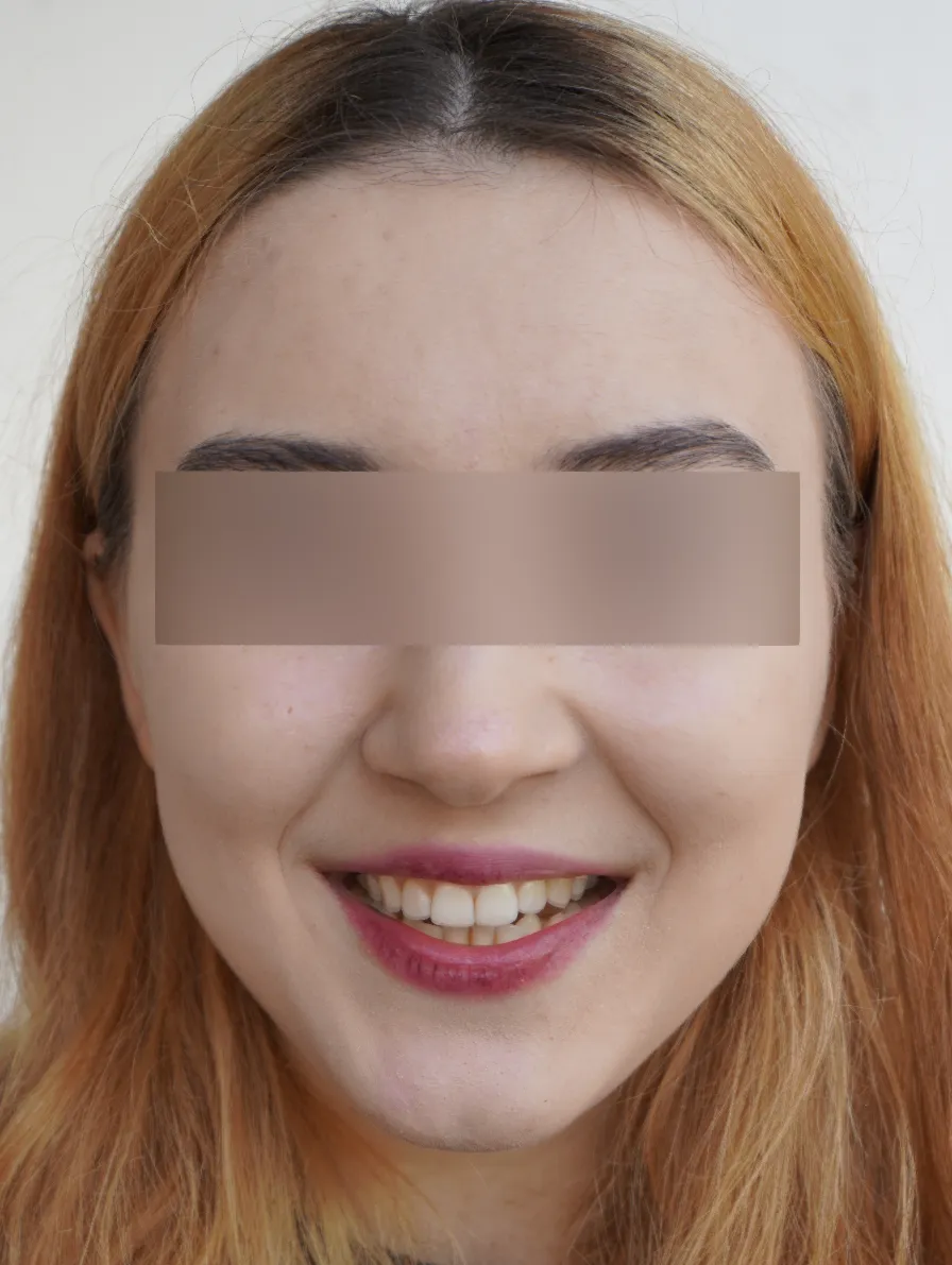 Smile Image.webp
