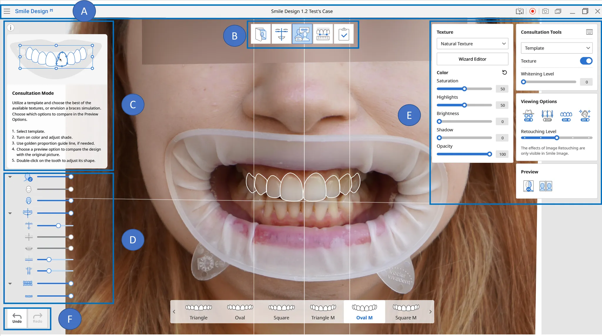 User Interface.webp