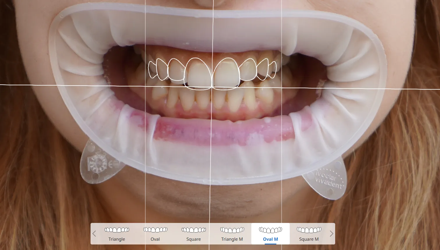 Template Editing 2.webp